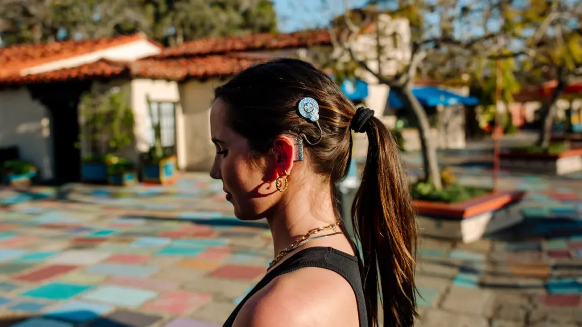 Young woman wearing a cochlear implant sound processor and magnetic headpiece while out in a colorful courtyard